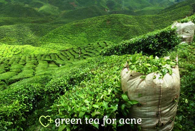 Green Tea for Acne