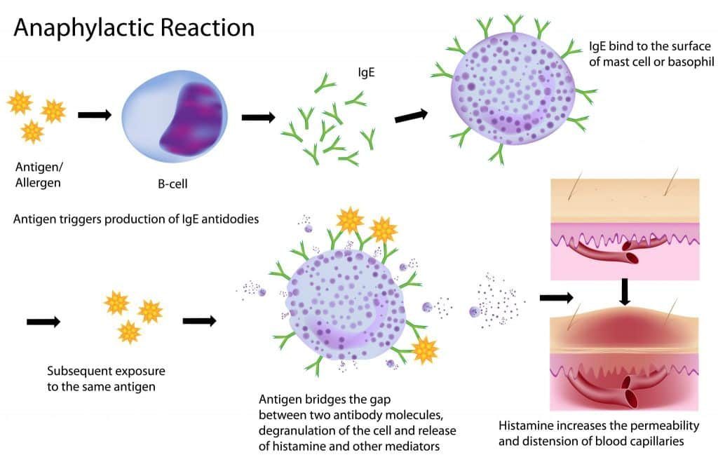 Anaphylaxis