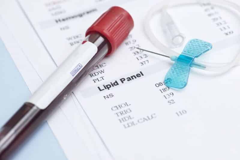 Cholesterol Blood Test