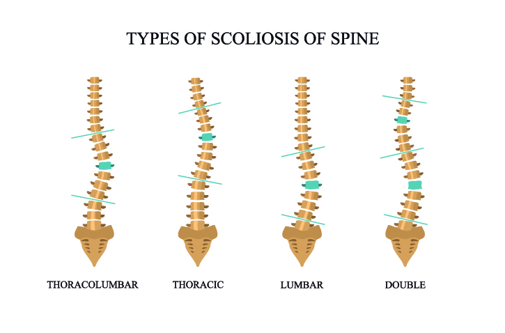 Spine curves